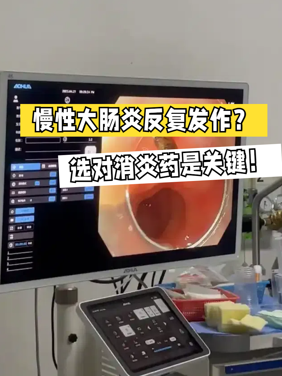 慢性肠炎的症状有哪些?