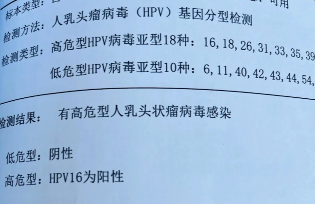 高度鳞状上皮内病变是什么病