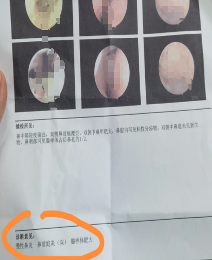 鼻疖是什么引起的?