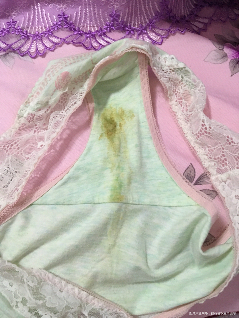 白带发黄,但是不痛不痒