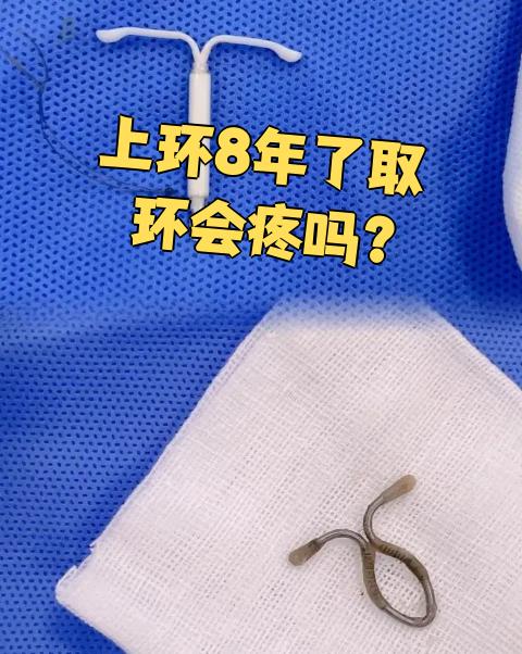上节育环可以终生不取下来吗?
