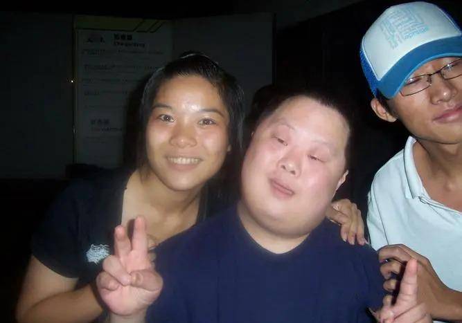 18三体综合症是什么