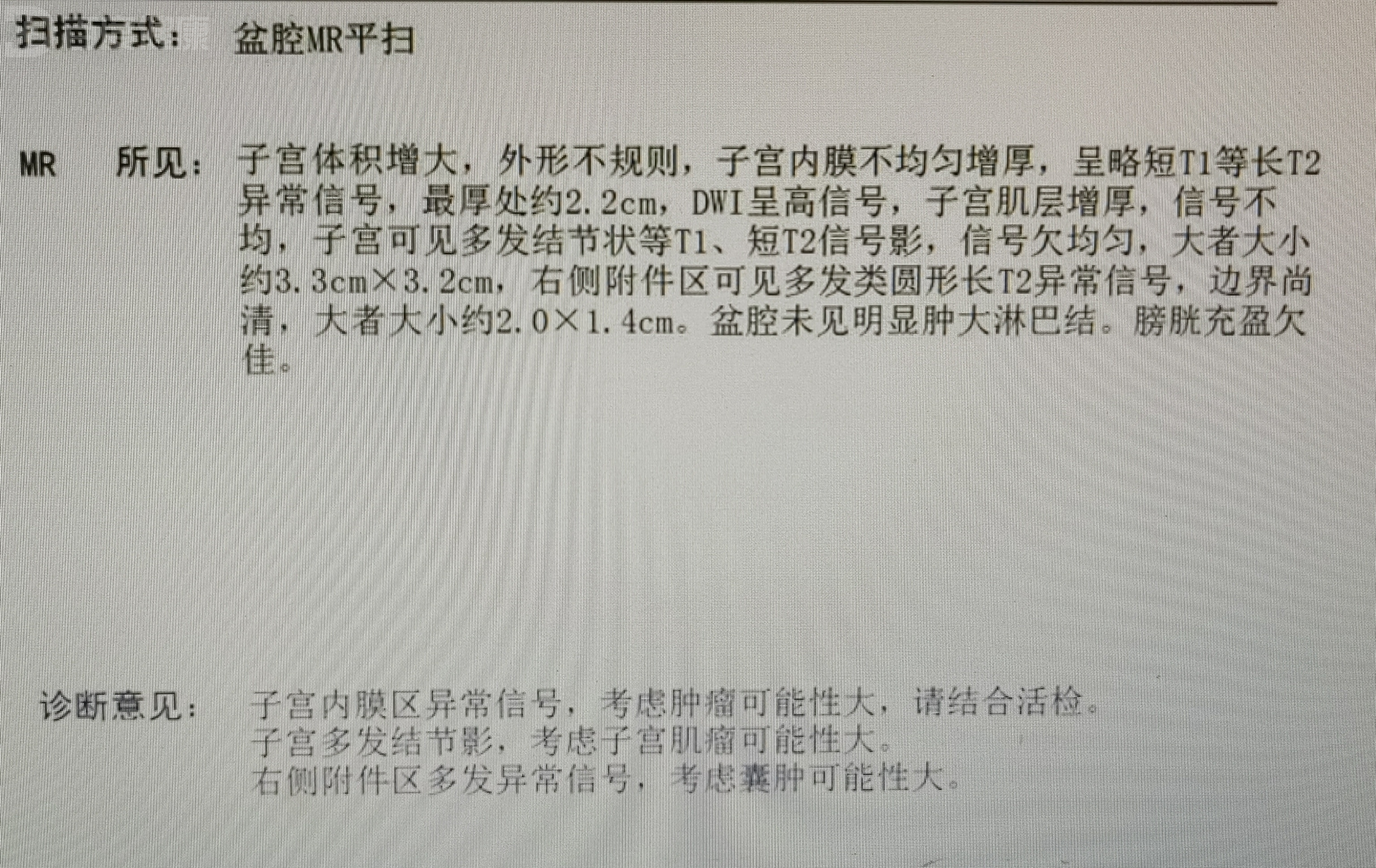 子宫内膜癌术后寿命