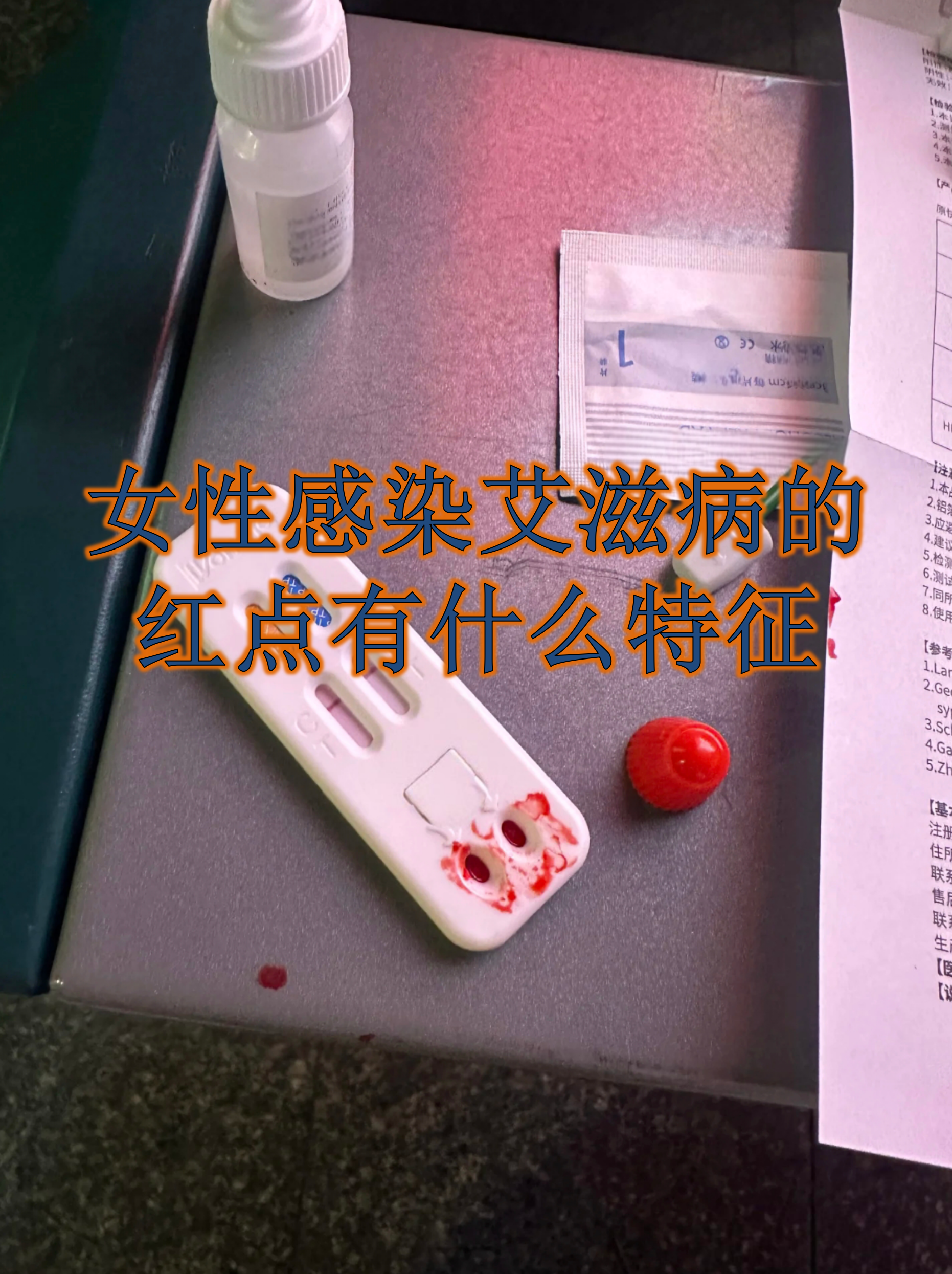 艾滋病多久出现症状