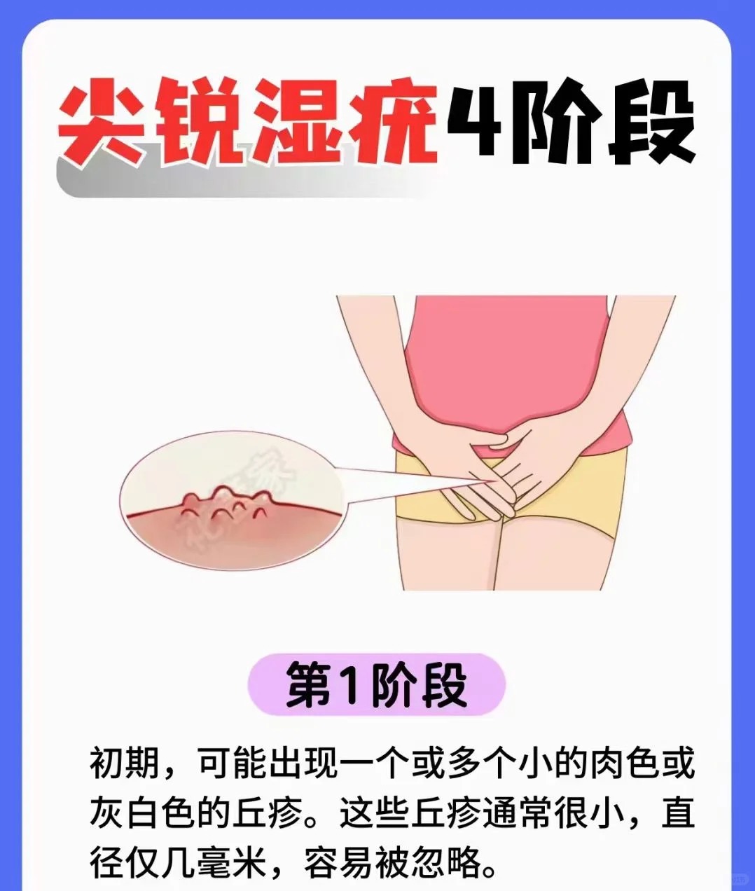 性病是怎么传染的