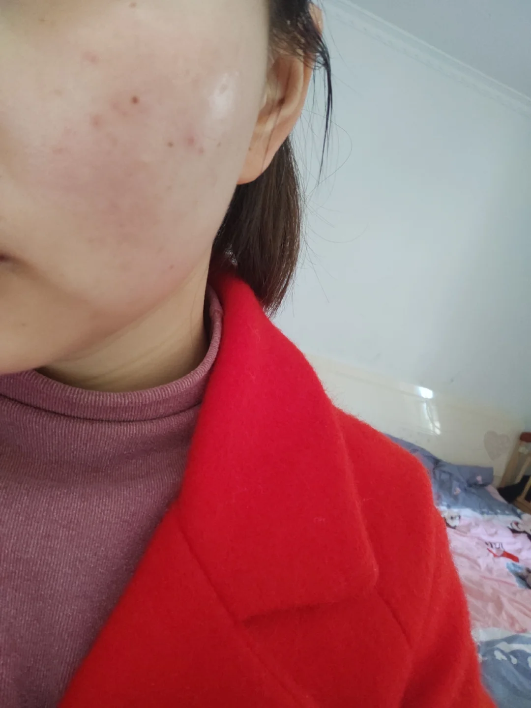 脸上长了许多红点怎么办