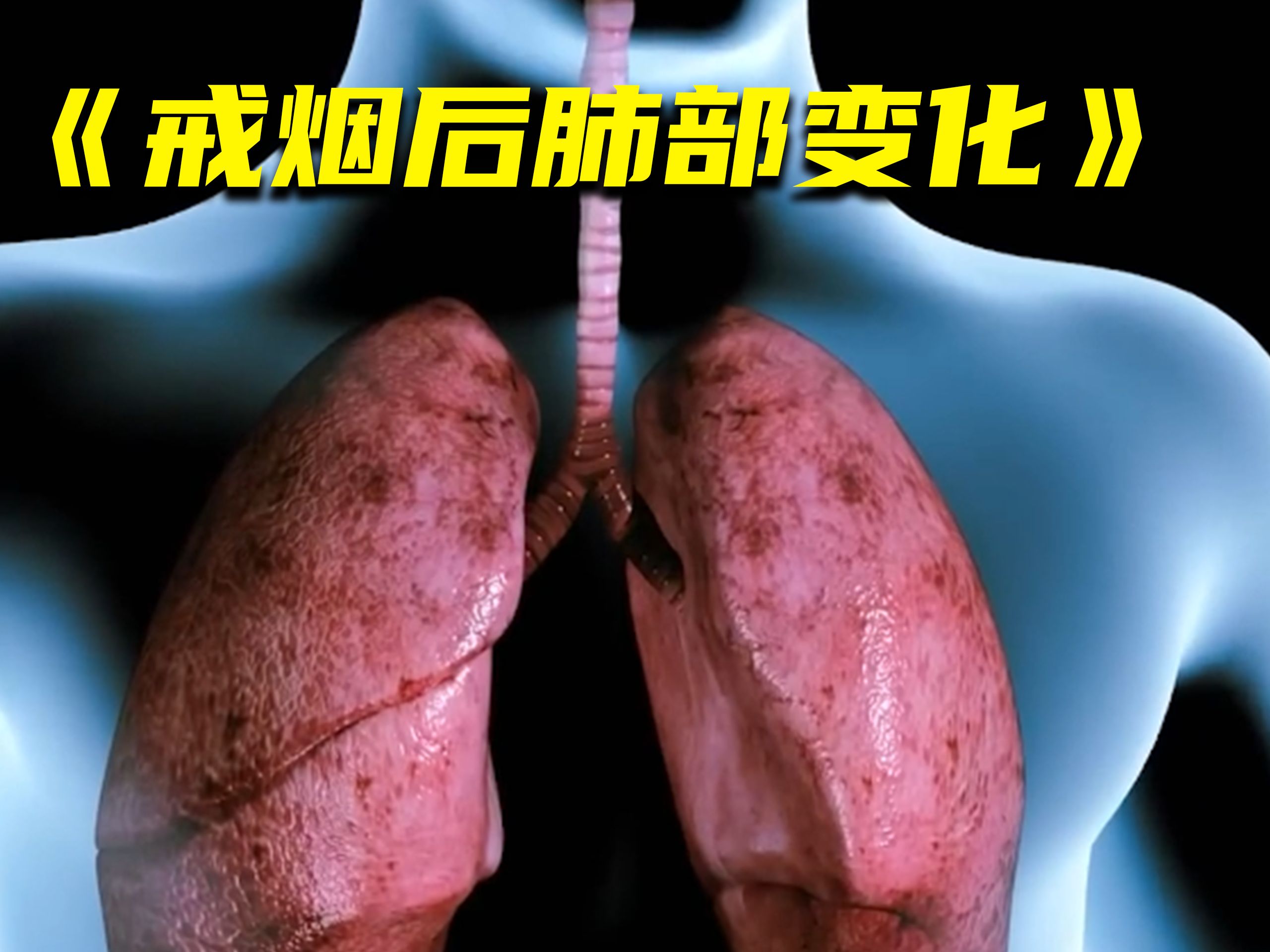 以前抽烟抽了五六年,现在戒烟1年了,肺部