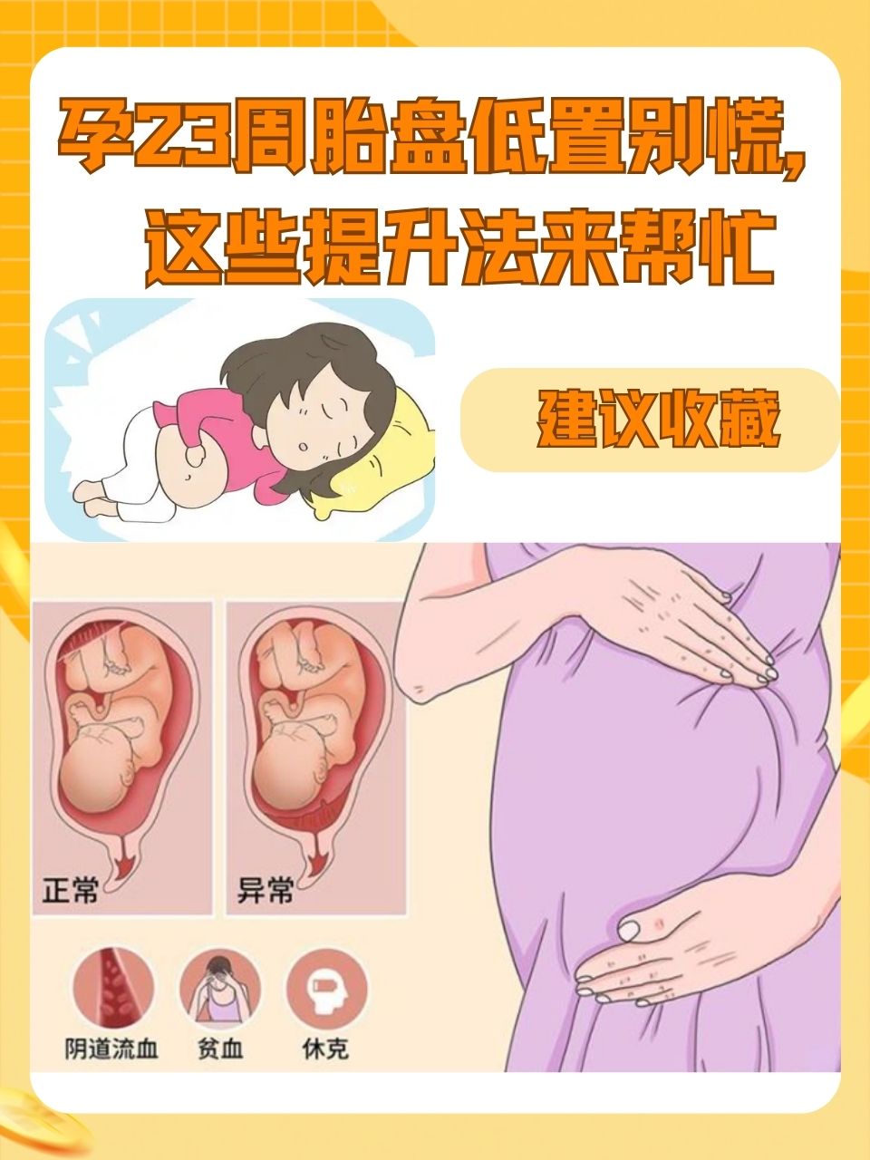 胎盘植入是什么意思