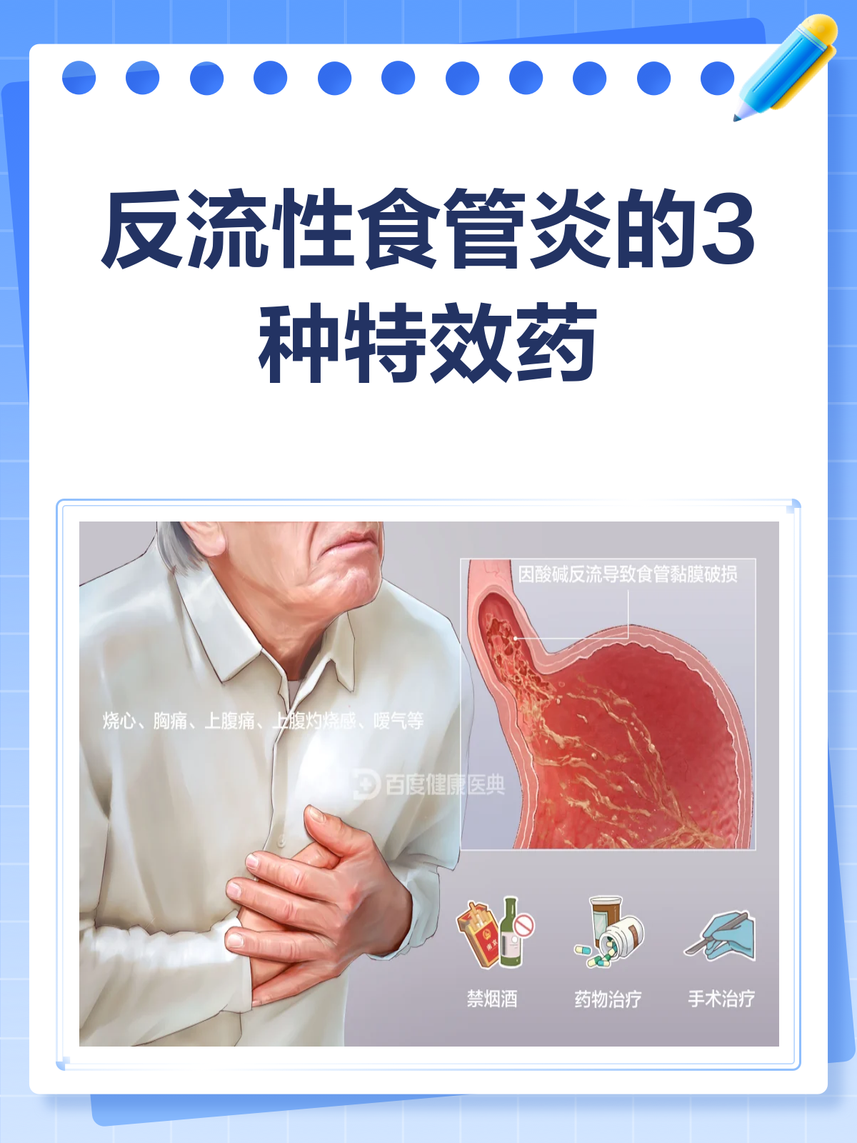 反流性食道炎吃什么药?