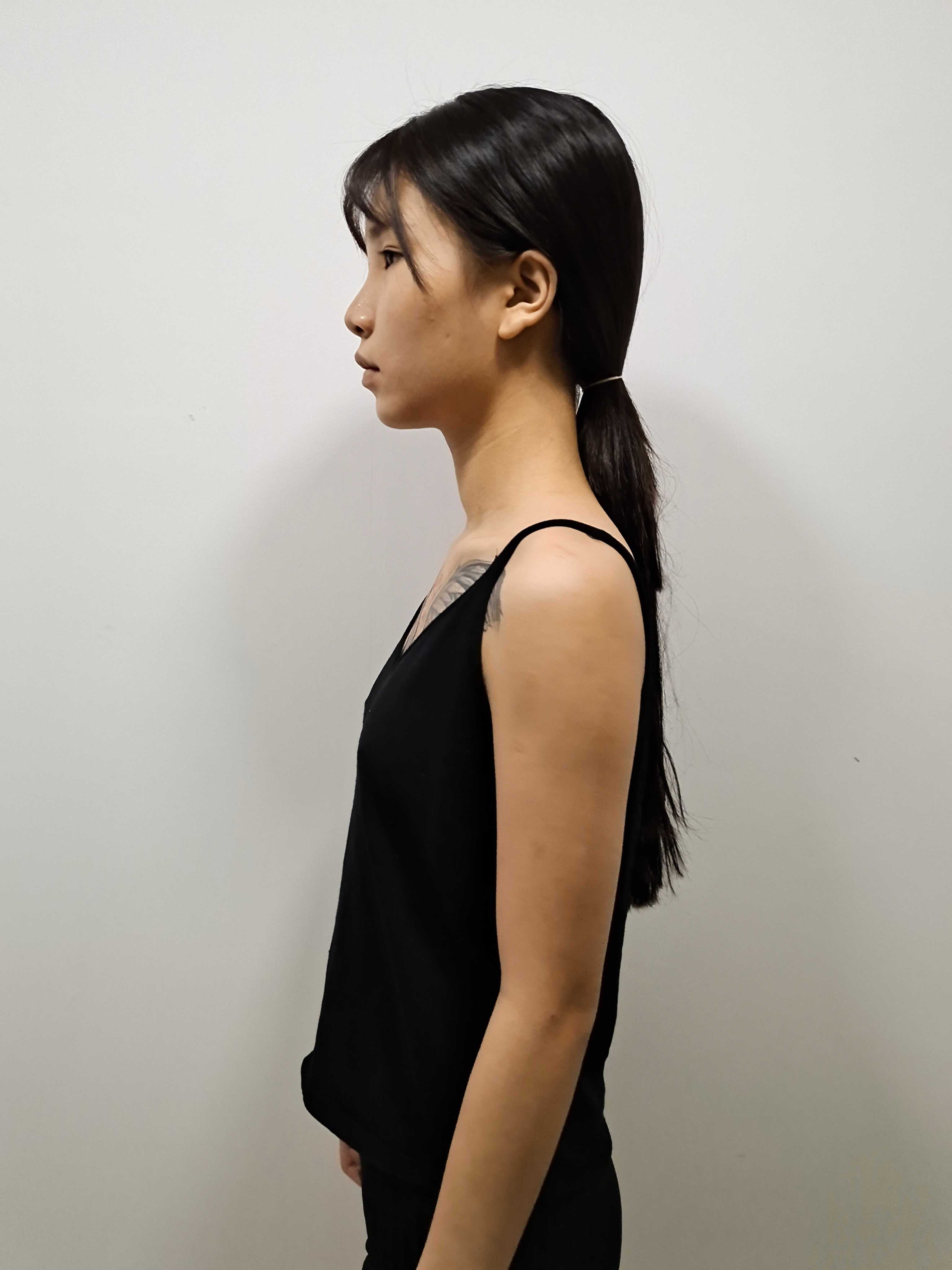 现在隆胸要多少钱呢?