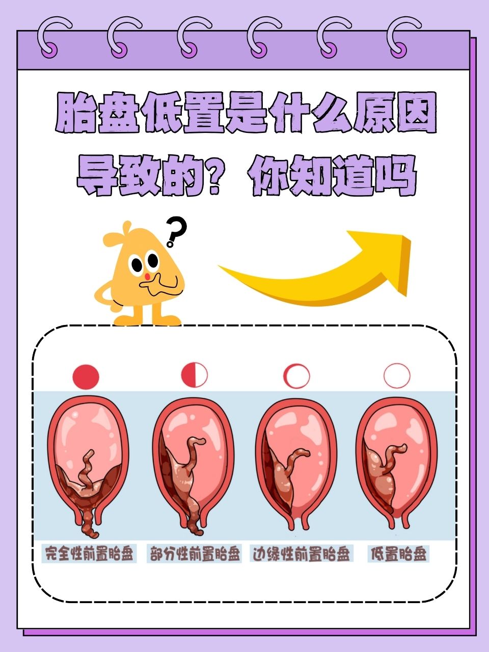 胎盘前置是什么意思?