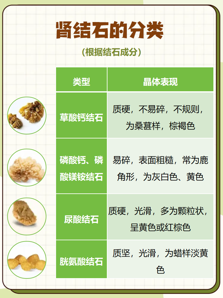 肾结石怎么引起的女性