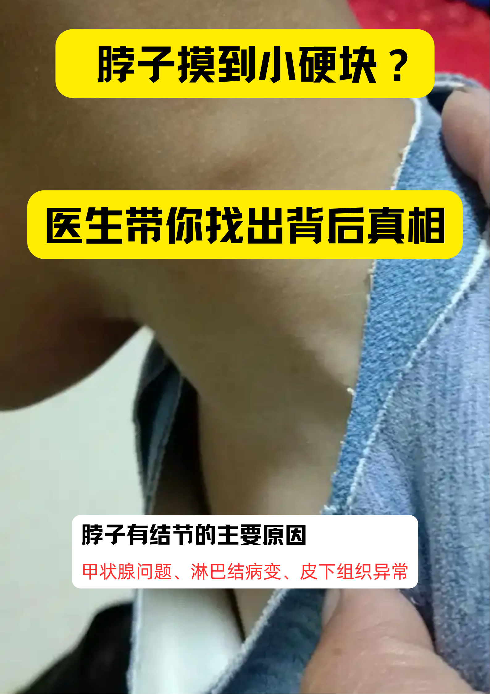 皮下结节是什么