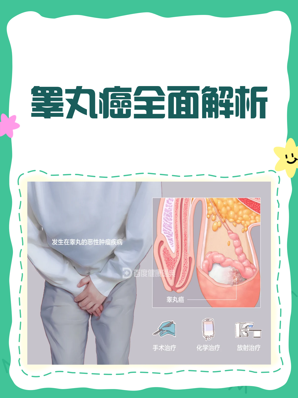 睾丸癌早期症状是什么