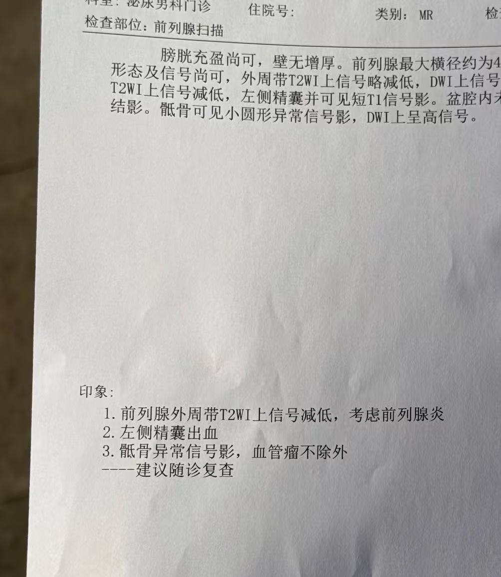 精子成块状是怎么回事..