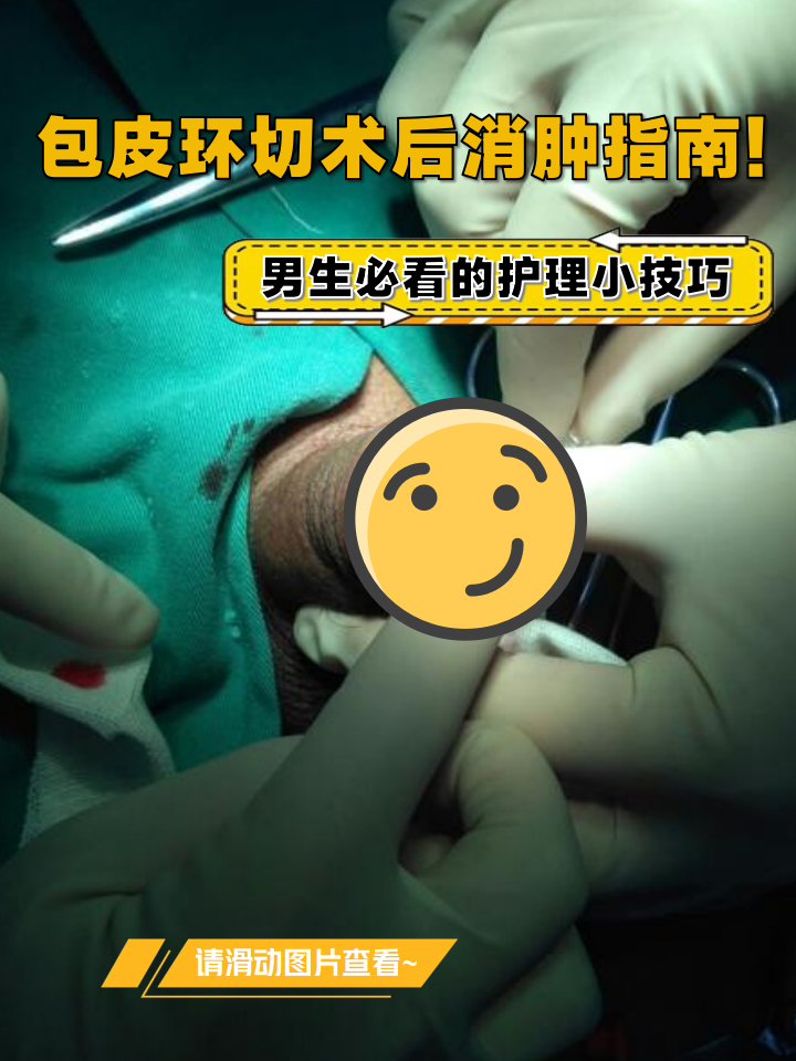 包皮手术多久可以拆纱布?