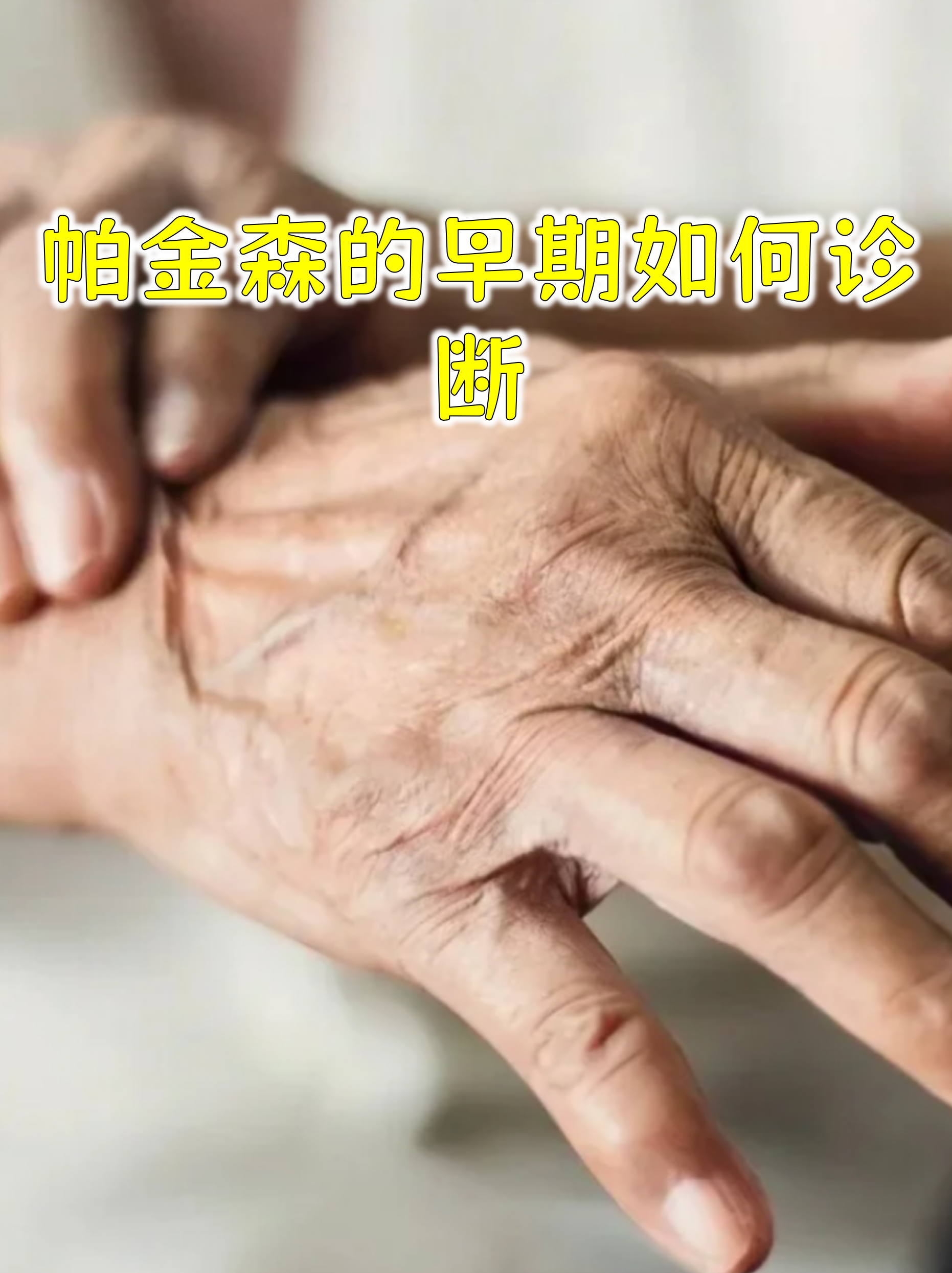 帕金森综合征和帕金森病的区别