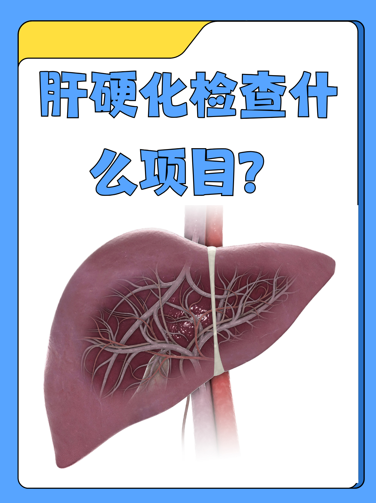 肝硬化会传染吗