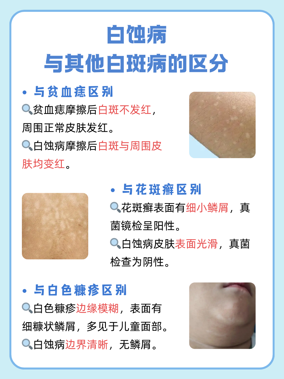 白殿病初期症状有哪些?