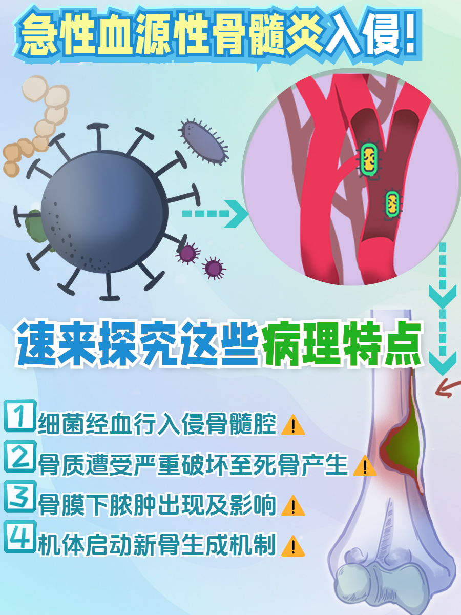 急性化脓性骨髓炎特点