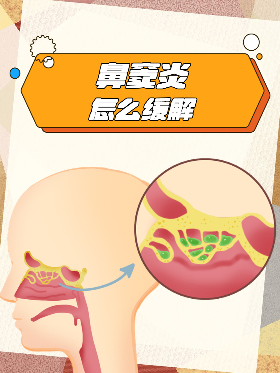 鼻窦炎头疼怎么能缓解