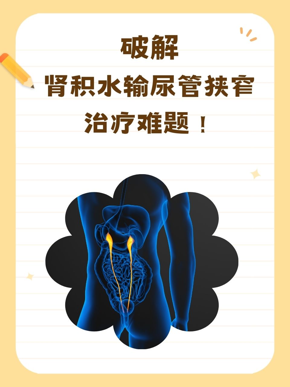 肾积水是什么原因引起的?