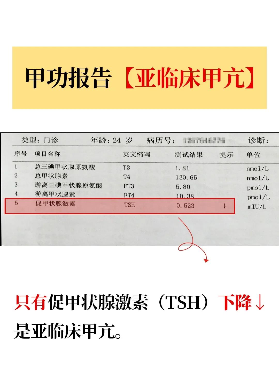 三碘甲状腺原氨酸偏低,怎么治疗?