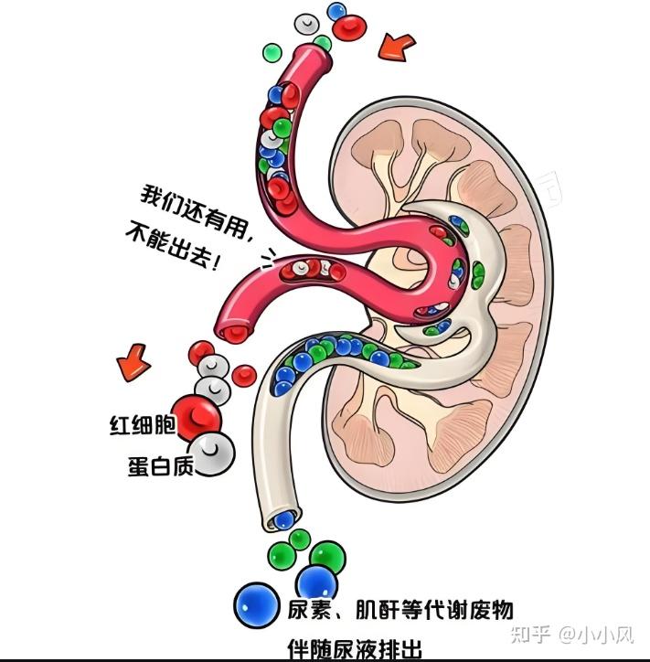狼疮性肾炎能活多久