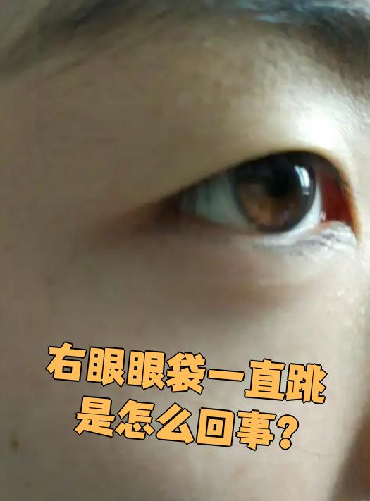 下眼睑老是跳怎么回事?