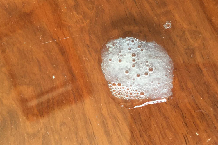 喉咙里老是有痰,是粘液状的