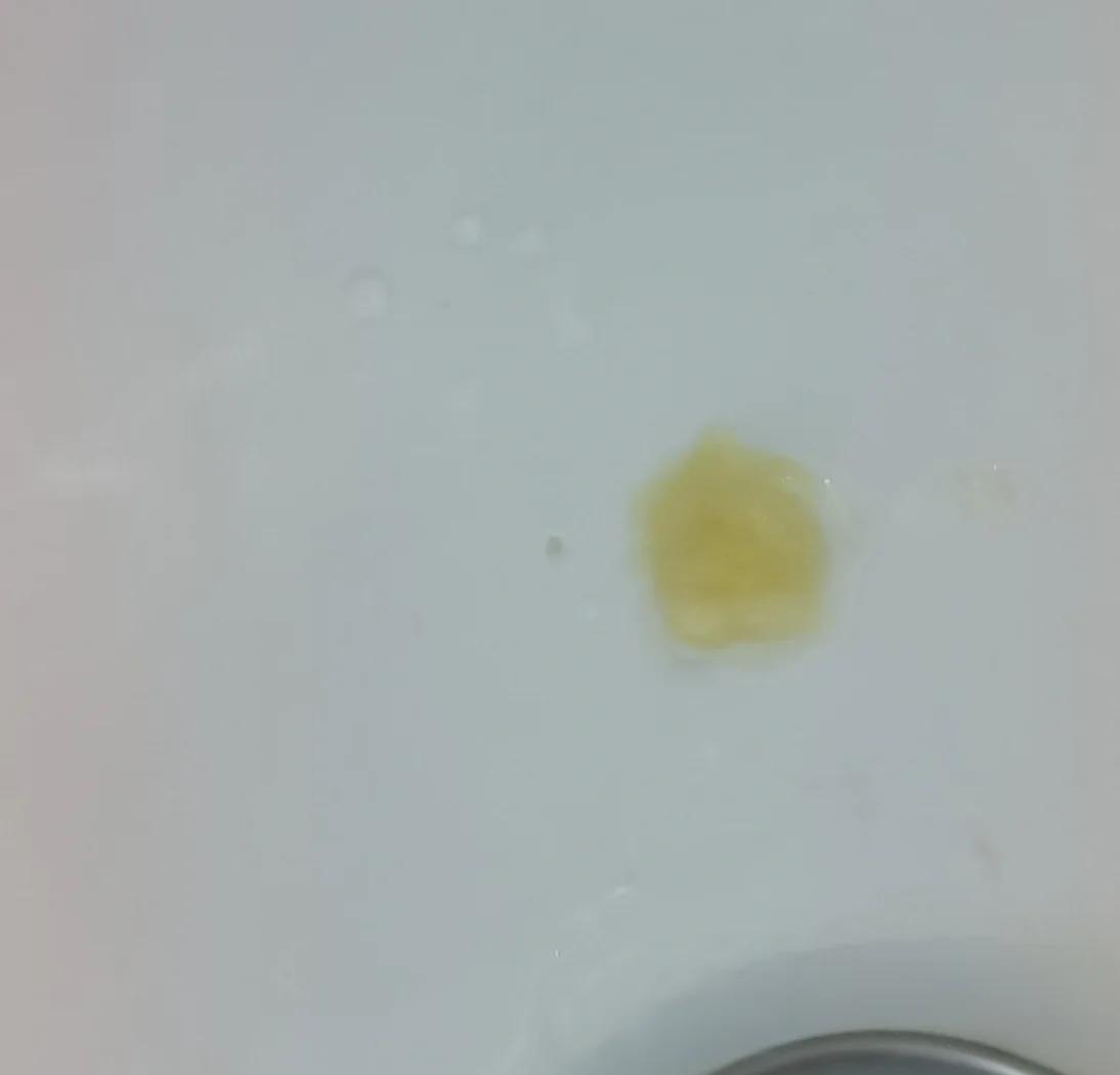 喉咙里老是有痰,是粘液状的