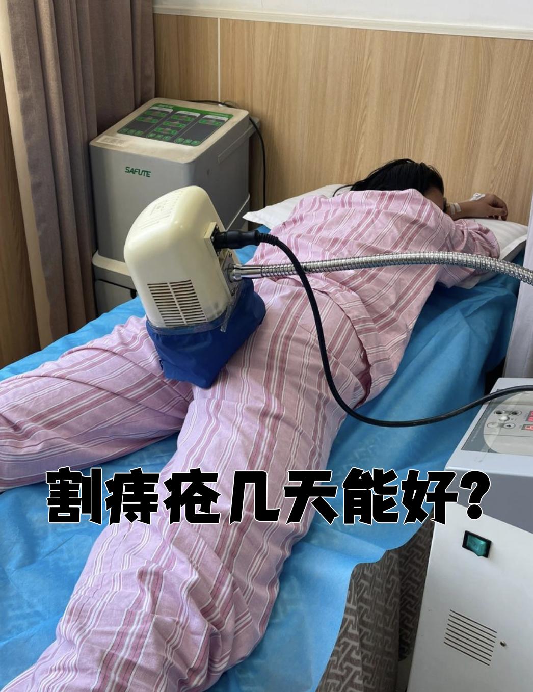 痔疮手术后多久能痊愈