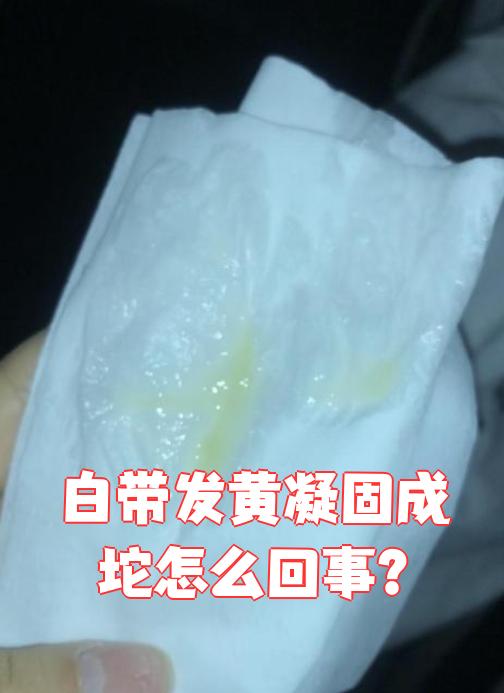 孕期白带增多正常吗