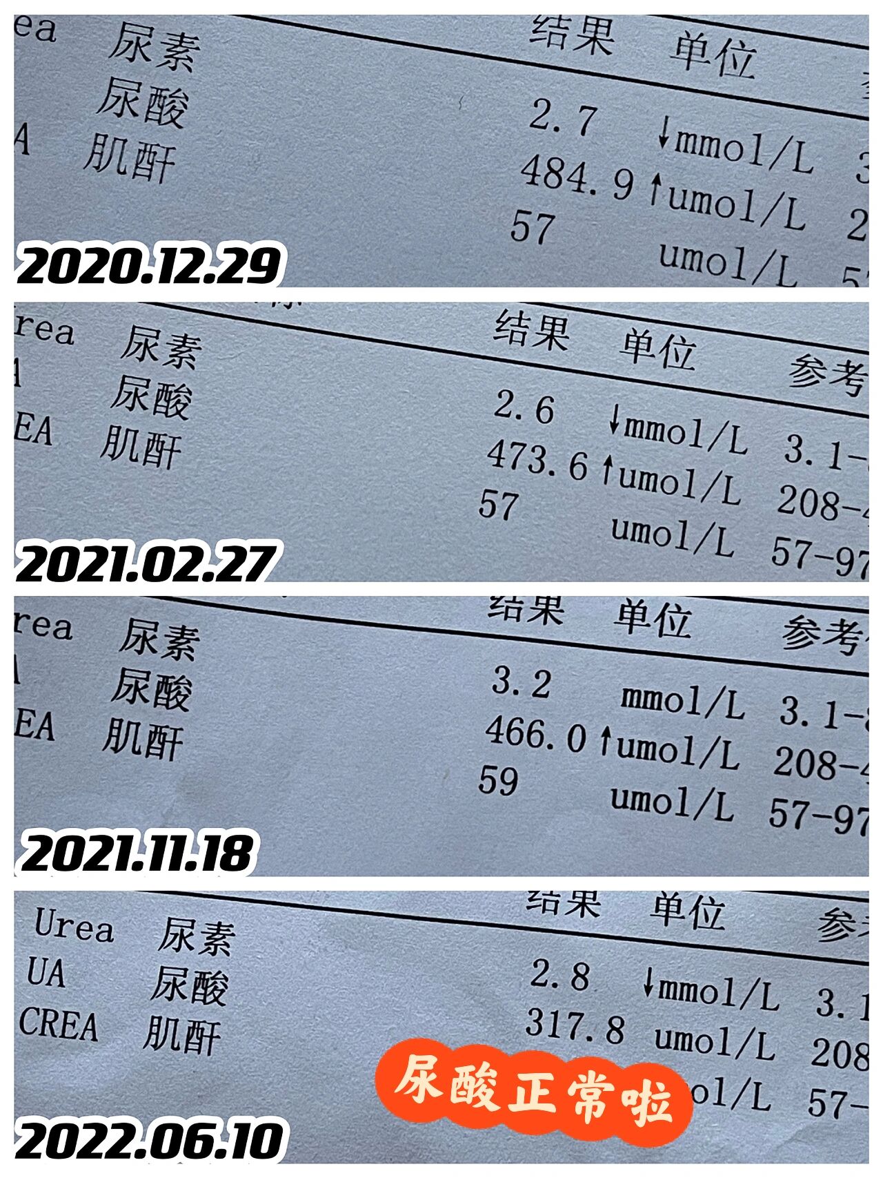 请问医生:尿素偏低是什么意思