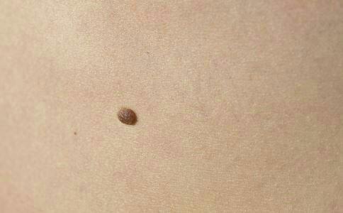 女人阴部有痣好吗..