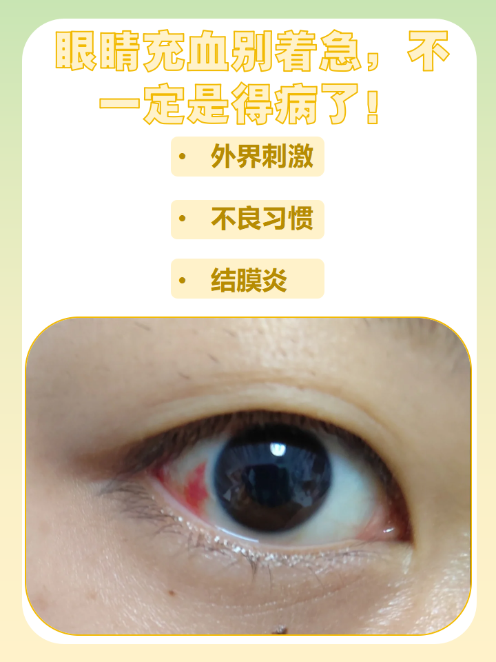 最近眼睛发红是什么原因