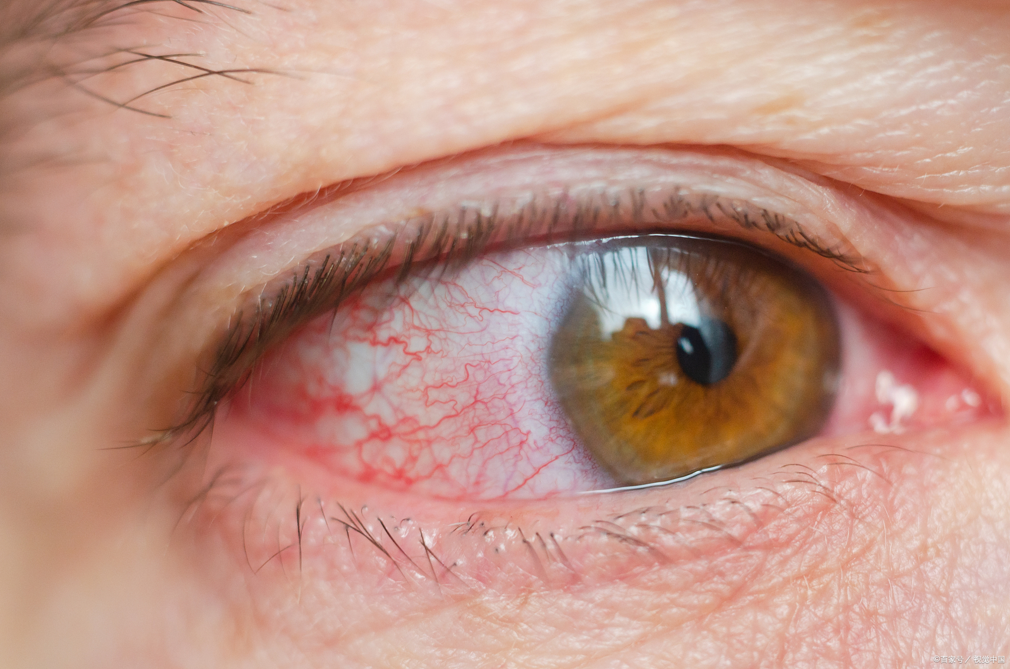 最近眼睛发红是什么原因