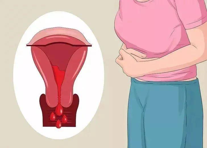 出现阴道出血是怎么回事