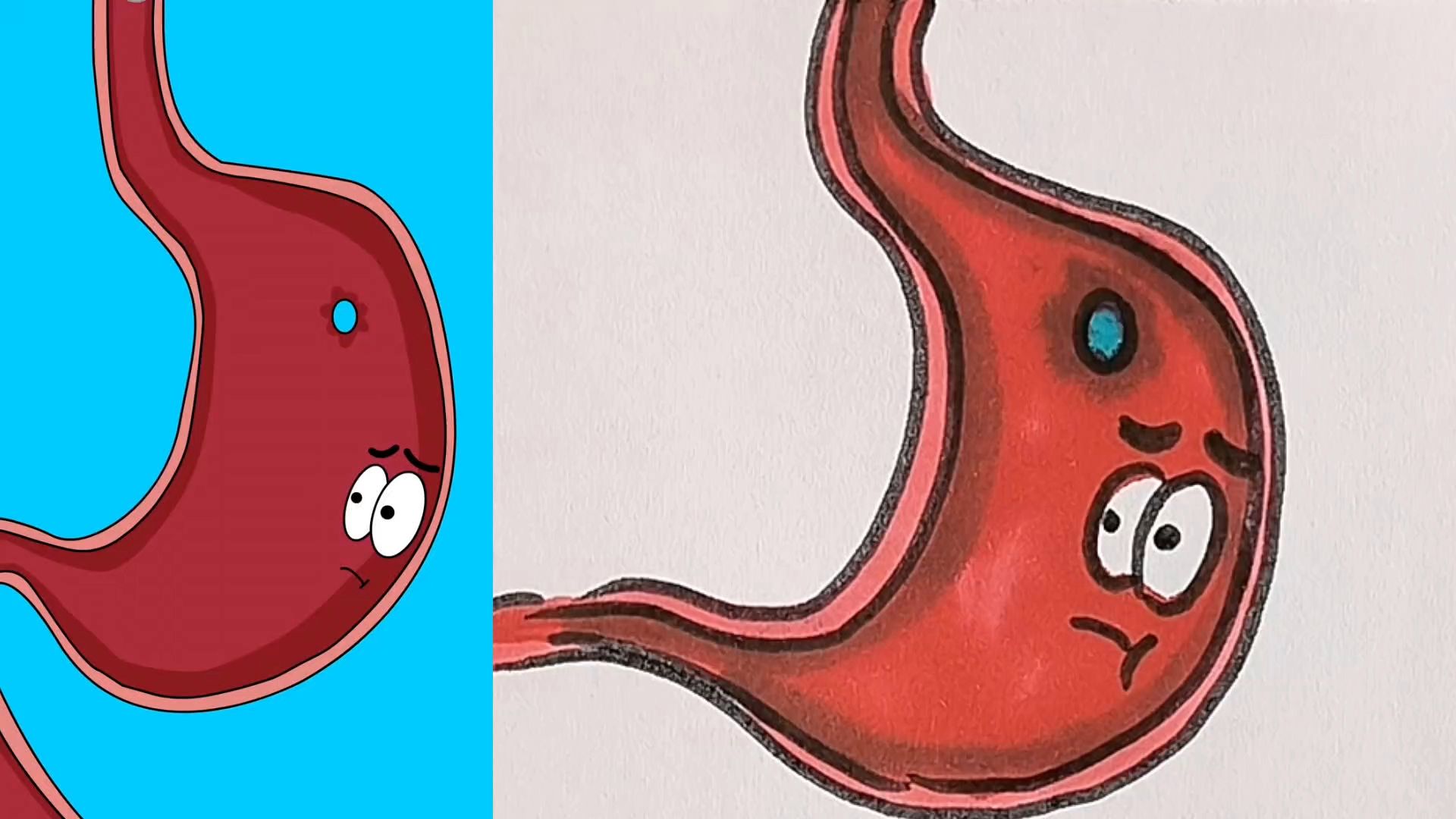 胃穿孔什么反应