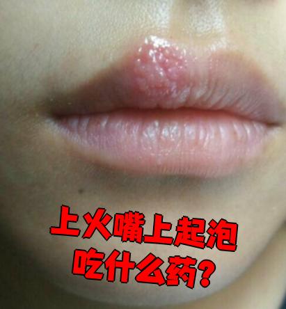 嘴上起泡是什么原因
