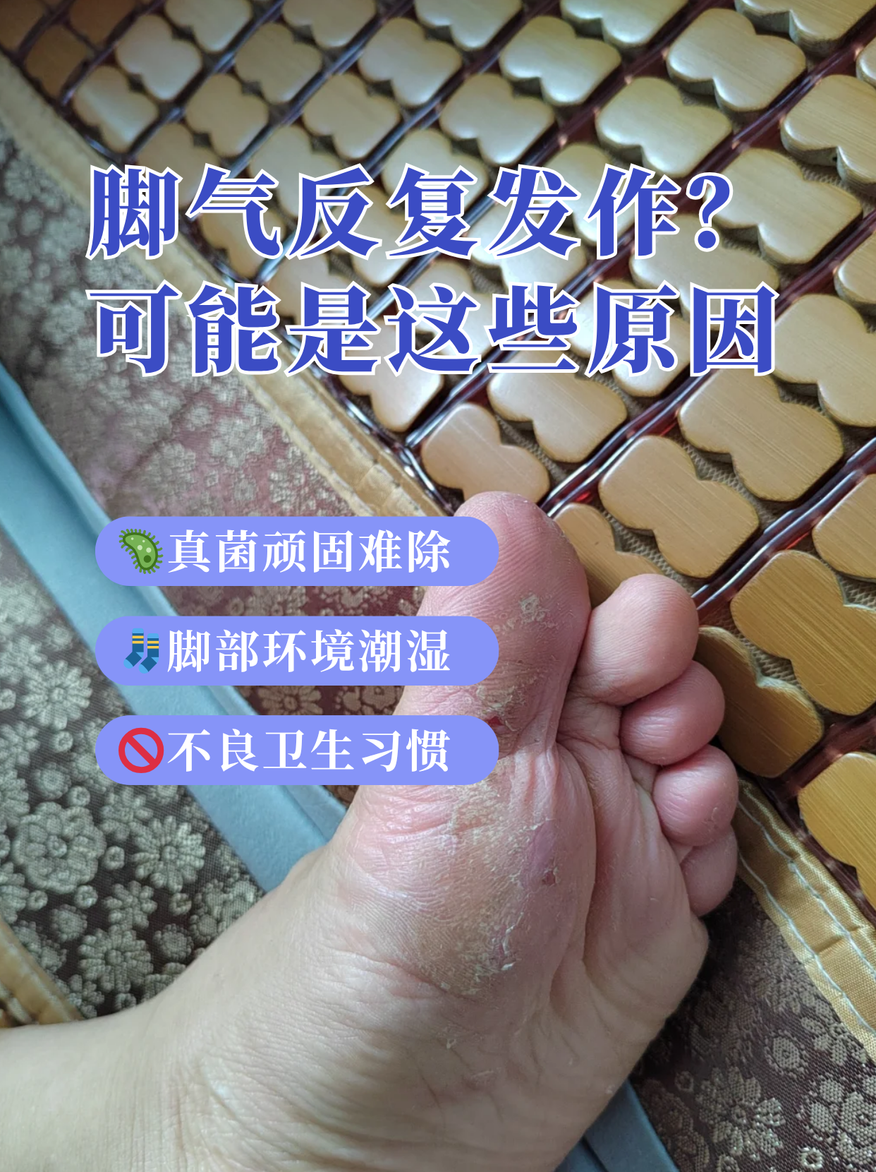 脚拇指上起了小泡泡是杂么回事?