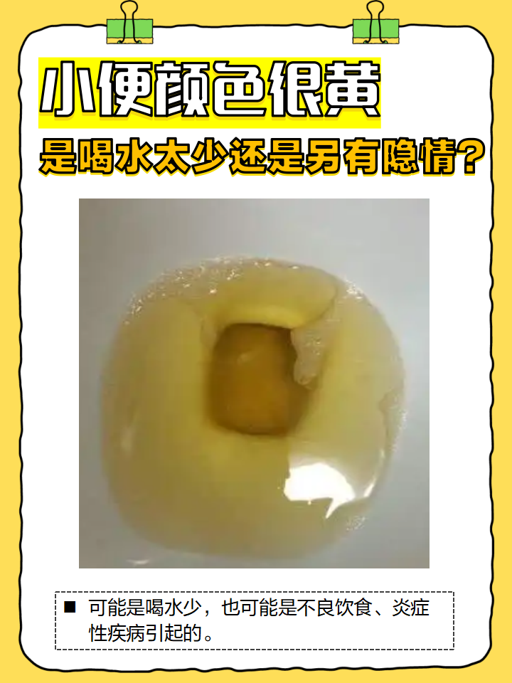 尿液偏黄色