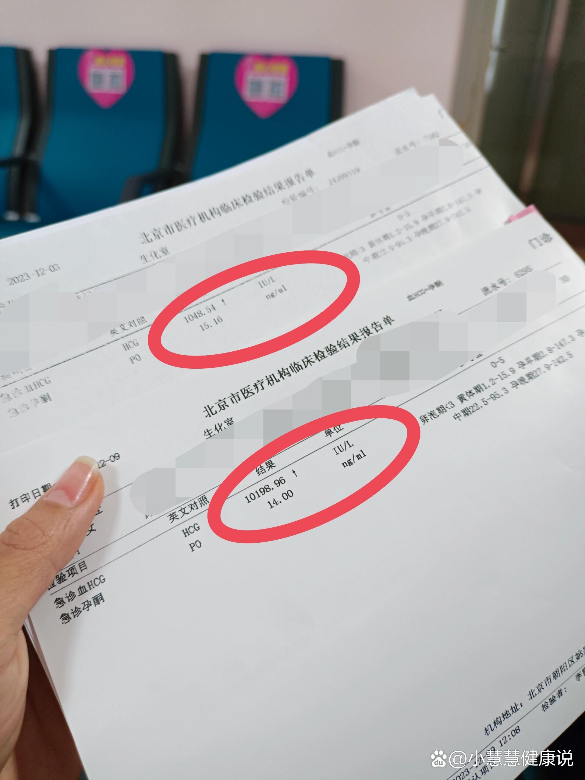 查孕酮怎么查是抽血吗