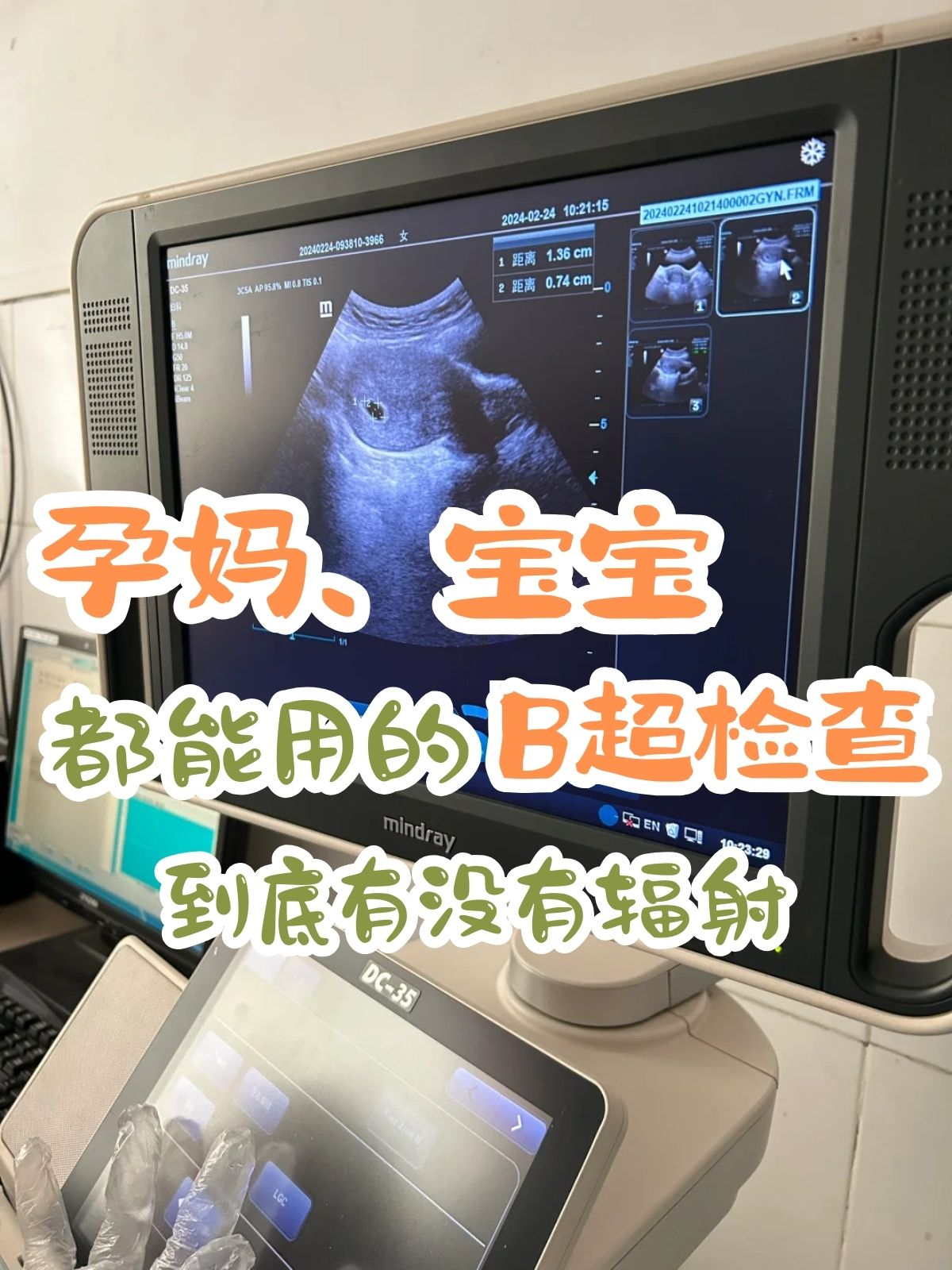 怀孕做彩超检查什么