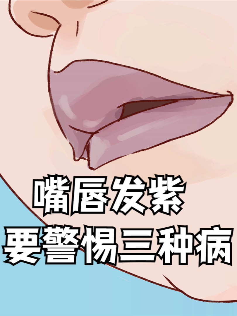 嘴唇发紫是什么原因