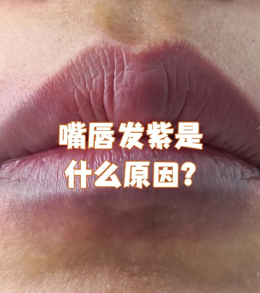 嘴唇发紫是什么原因