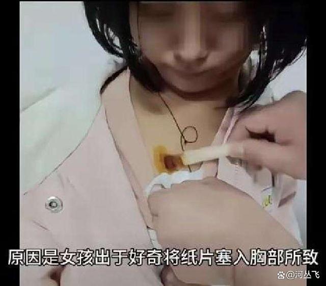 我14岁胸就这么大了