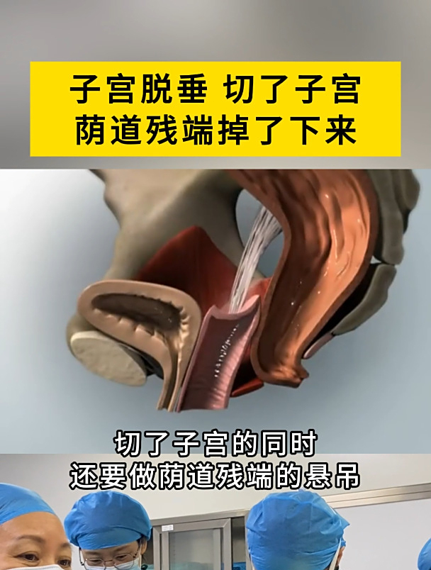 子宫切除会出现哪些后遗症