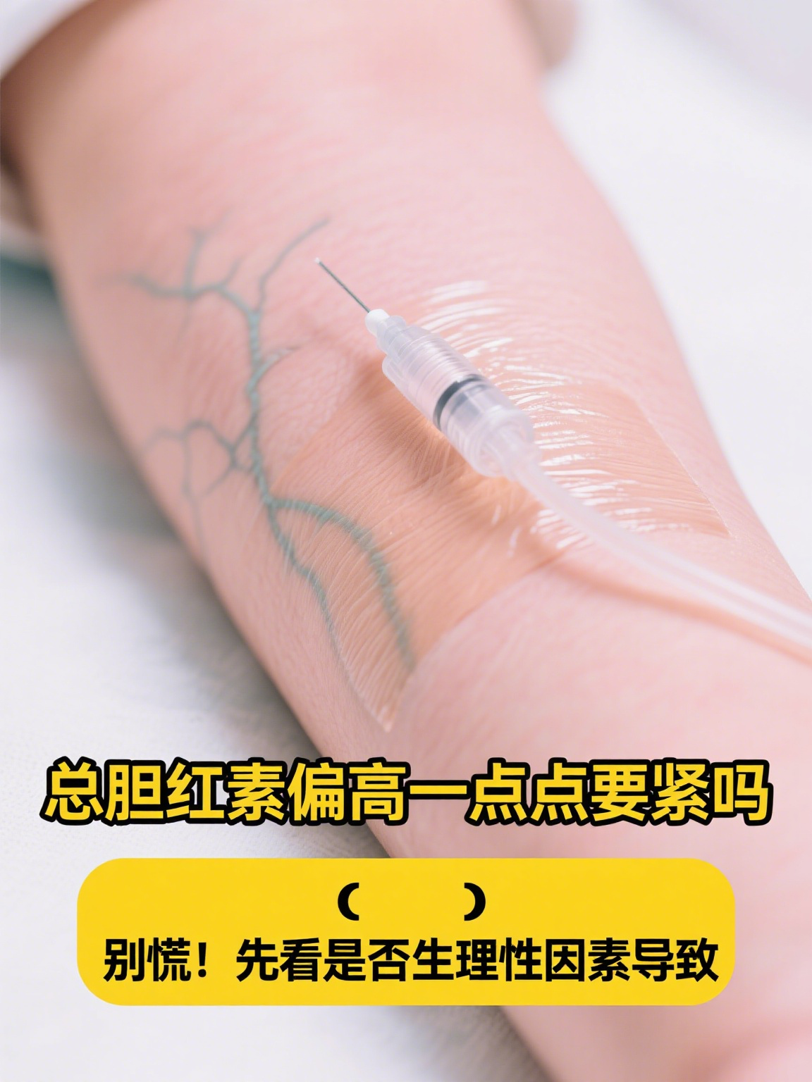 只有总胆红素偏高,要紧吗?