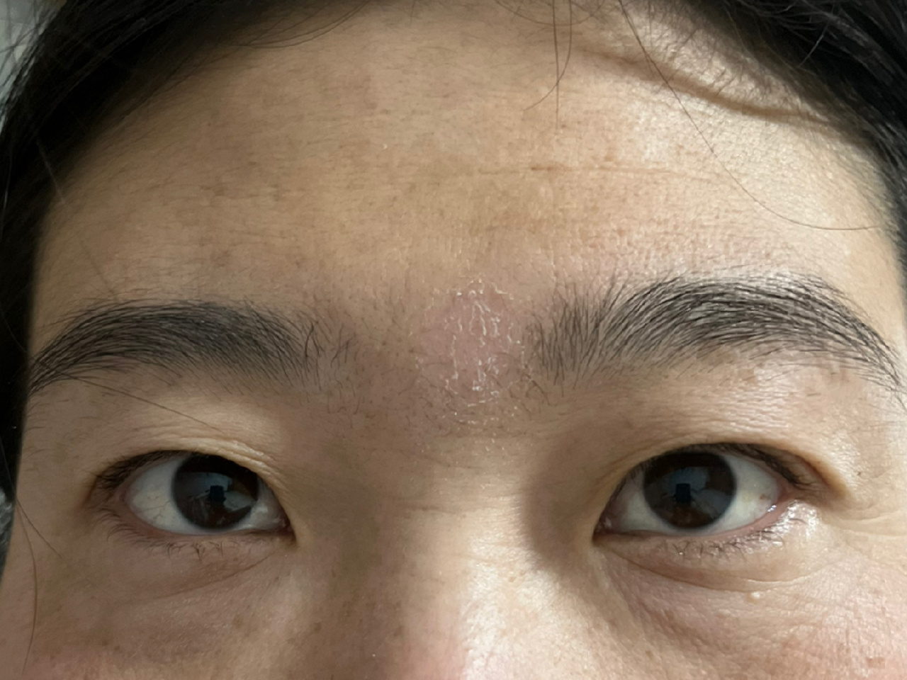 脸上起的像癣一样的白色块状,